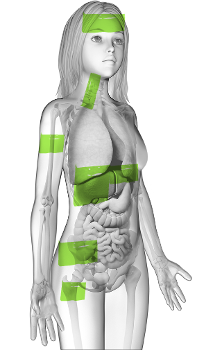 Female MAS patient highlighted